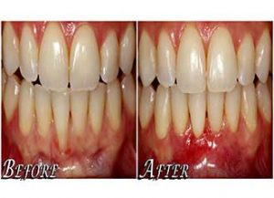 Gum disease specialist in Kolkata