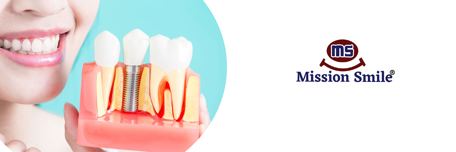 implantology banner Image
