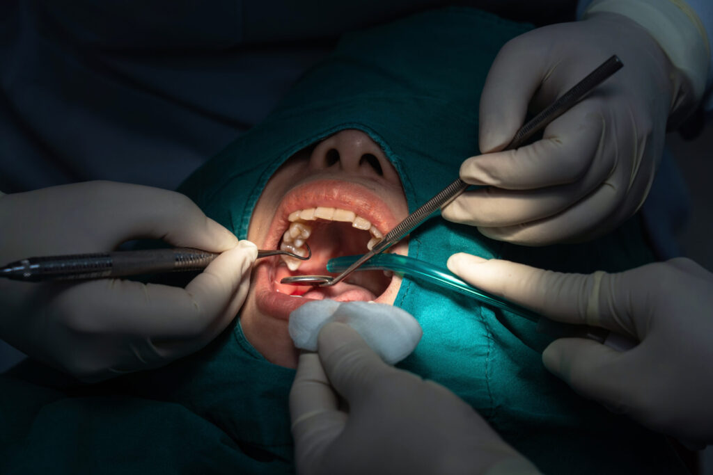 Affordable dental crowns Kolkata