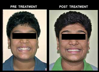 best dental clinic ballygunge kolkata