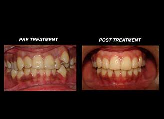 good dental clinic in ballygunge kolkata