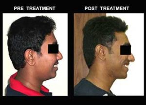 best smile dental clinic ballygunge