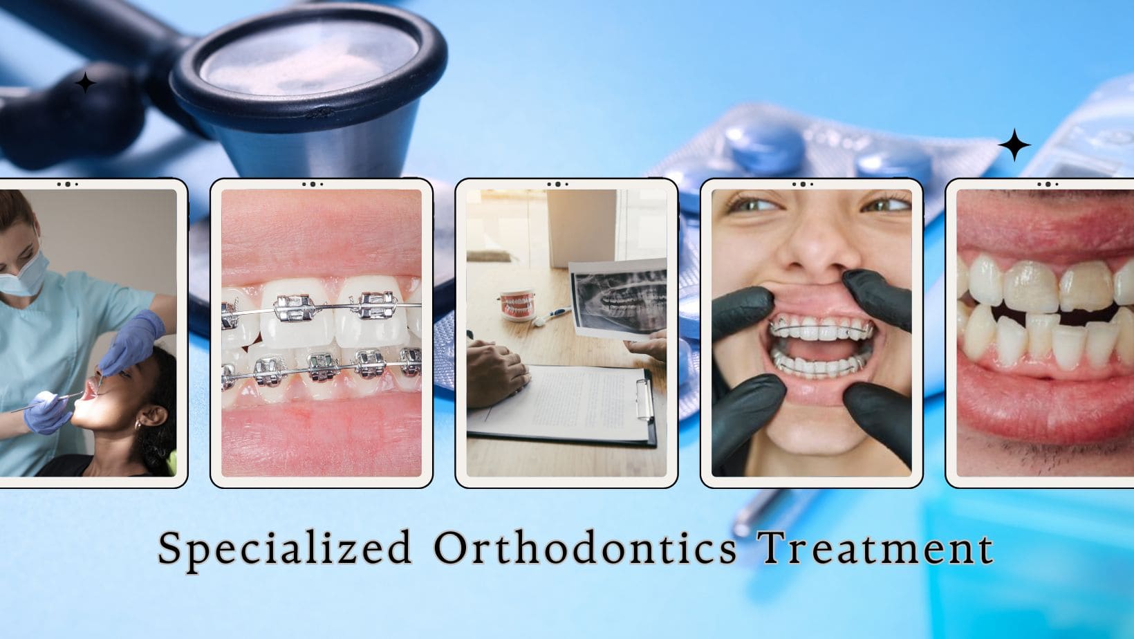 Discover The Various Types of Orthodontic Treatment in Kolkata