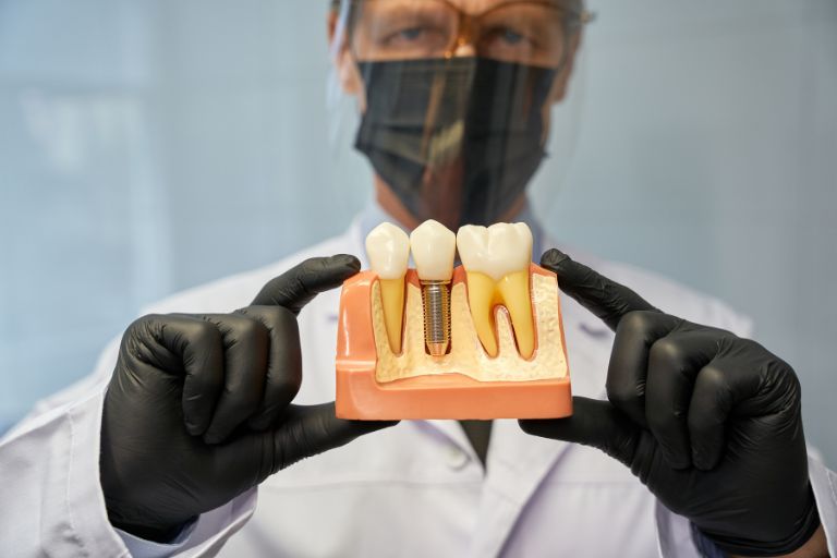 Dental Implants in Kolkata