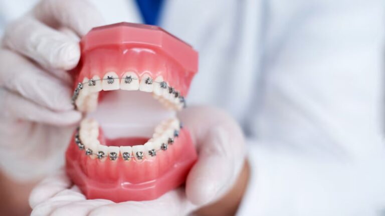 What is the Teeth Orthodontics Cost in Kolkata in 2025?