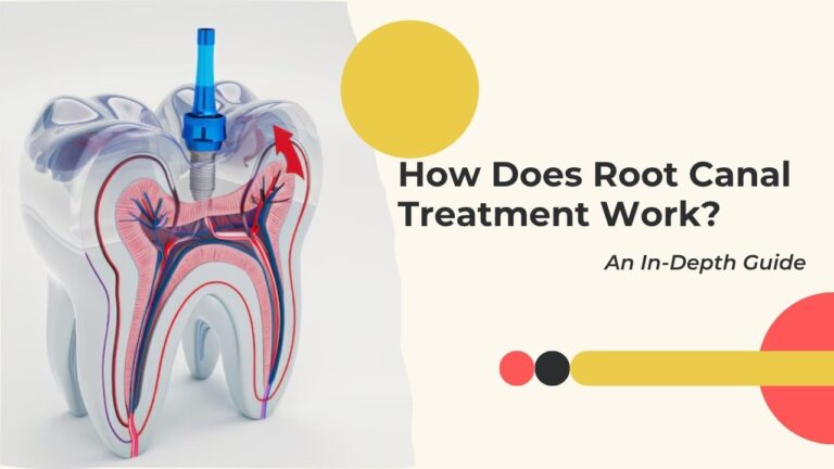 How Does Root Canal Treatment Work? An In-Depth Guide