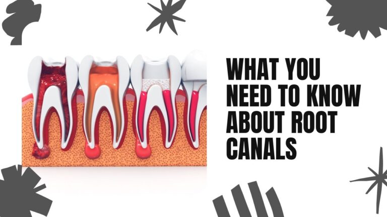 What You Want to Know About Root Canal Treatment in Kolkata