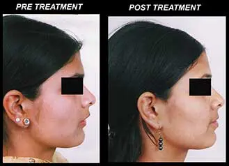 best orthodontic treatment in ballygunge kolkata