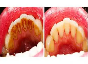 Top Periodontist in Kolkata