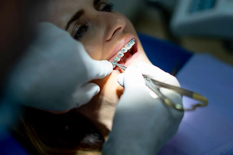 best dental braces clinic in kolkata