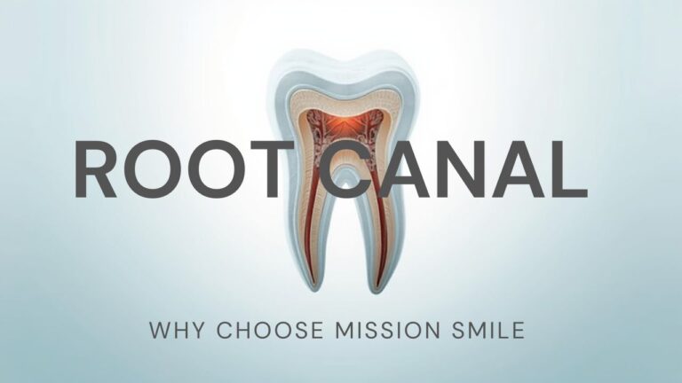 Why Choose Mission Smile for Root Canal Treatment in Kolkata?