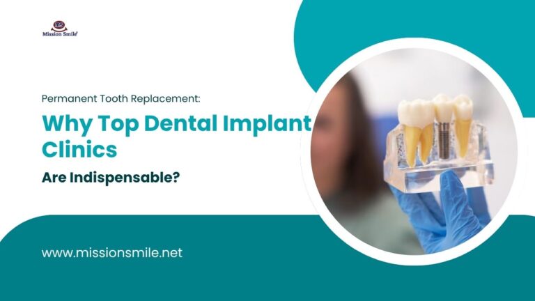 Permanent Tooth Replacement: Why Top Dental Implant Clinics are Indispensable?