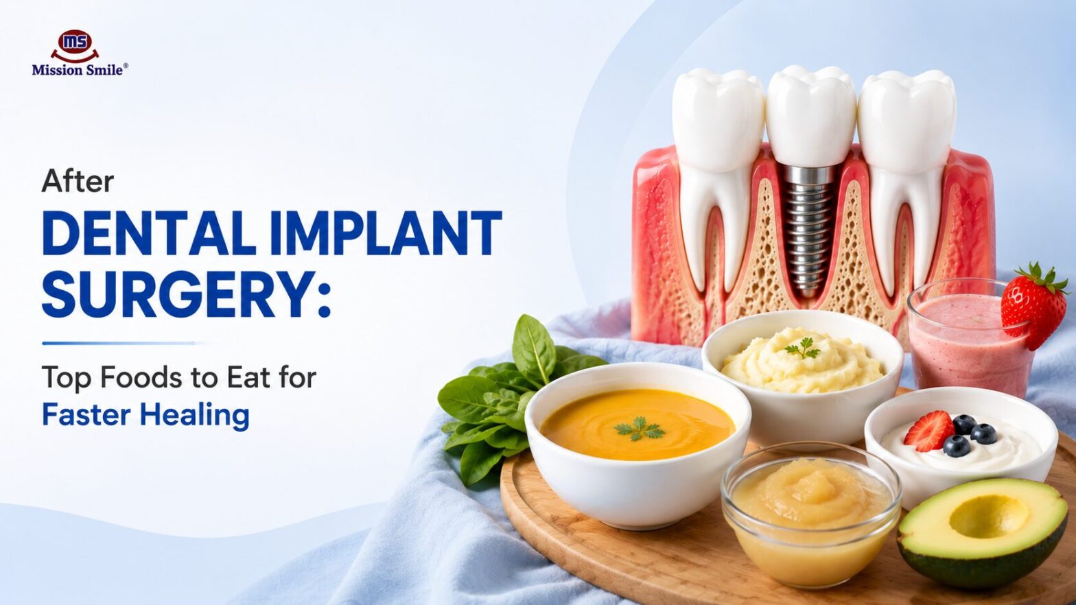 Dental Implant Surgery in Kolkata