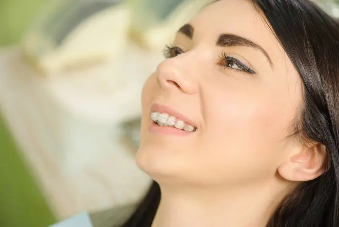 transparent teeth braces in Kolkata