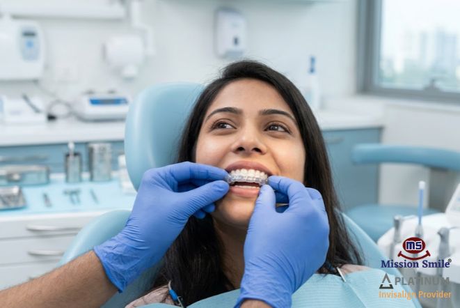 Invisalign Aligners Kolkata